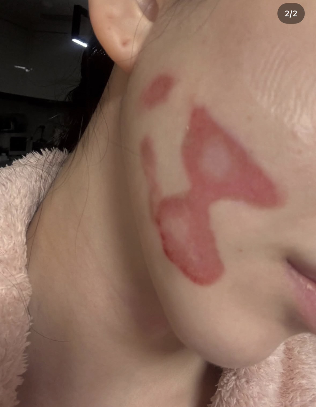 슈링크로-화상입었다는-권민아-인스타글.jpg-1-이미지