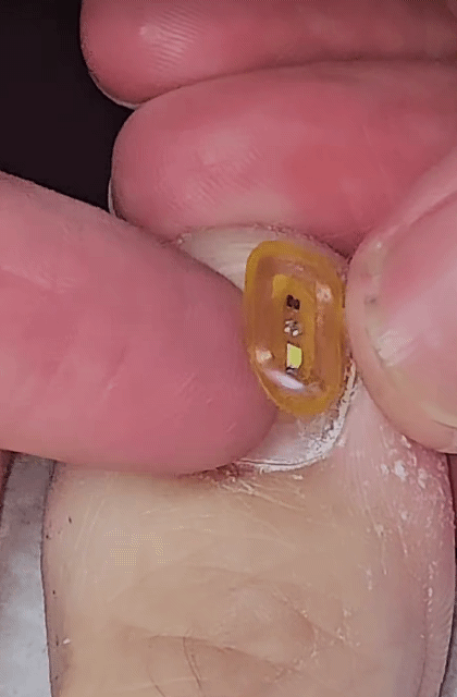 발톱-패디큐어-1-이미지