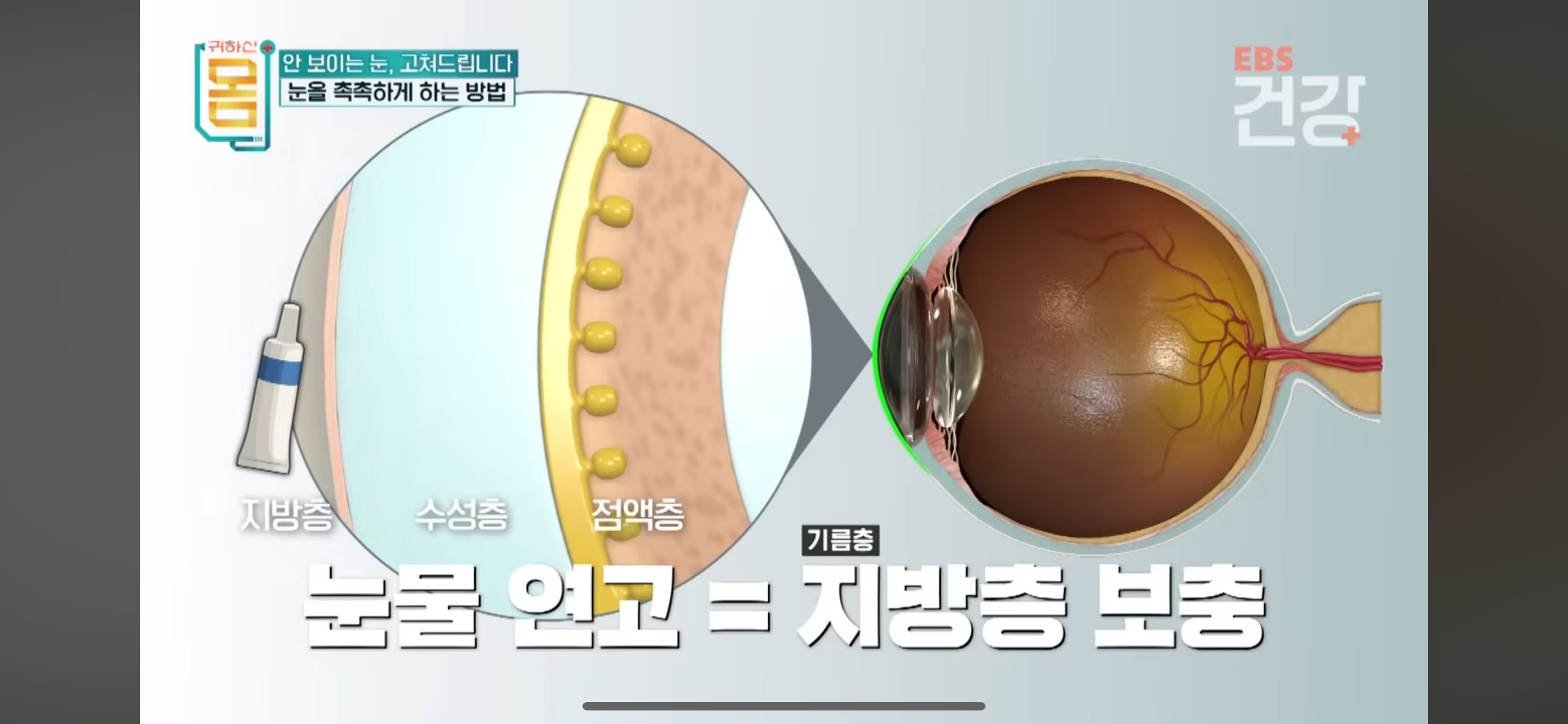안구건강관리법-메모-2-이미지