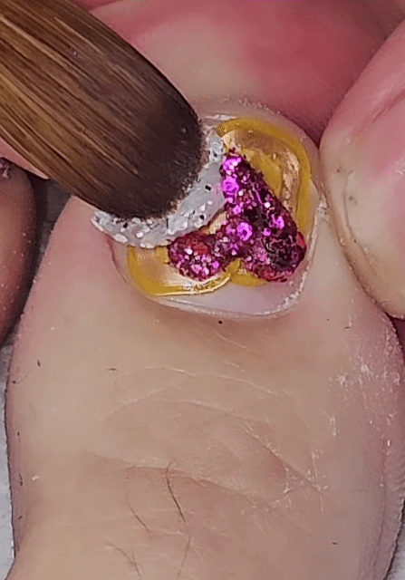 발톱-패디큐어-2-이미지