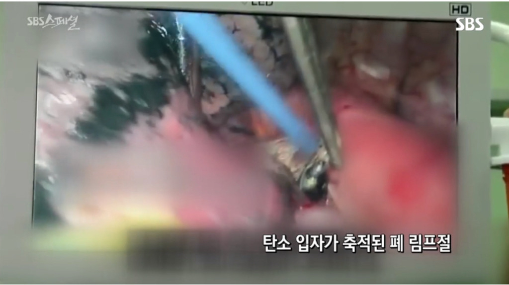 중국-현지-사례로-보는-미세먼지의-위험성.jpg-14-이미지