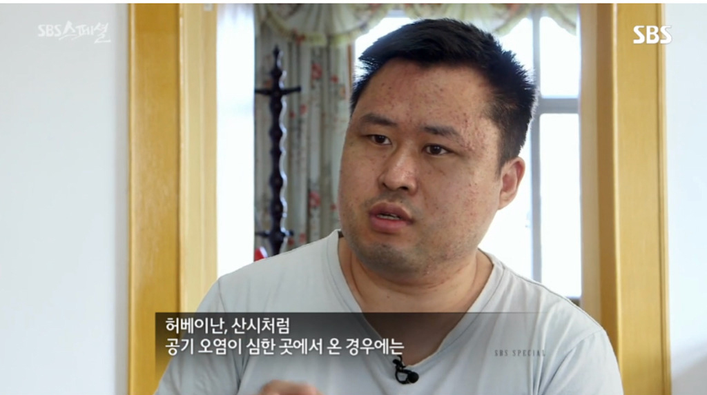 중국-현지-사례로-보는-미세먼지의-위험성.jpg-12-이미지