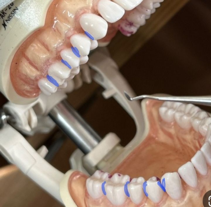 백날-열심히-칫솔질-치실질해도-안-닦이는-부분-있는-달글-(부제-:-첨단칫솔-쓰세요)-3-이미지