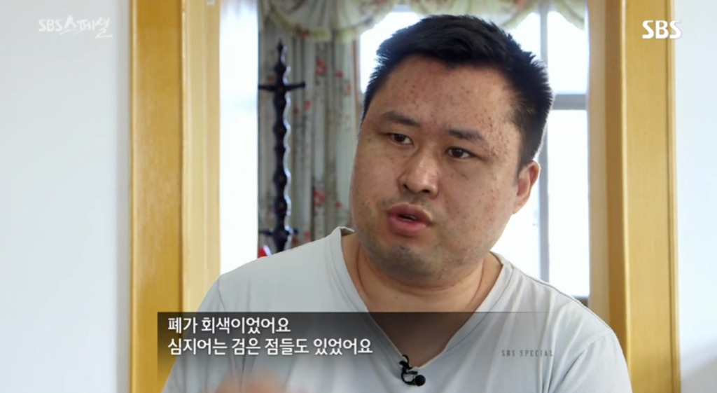 중국-현지-사례로-보는-미세먼지의-위험성.jpg-13-이미지