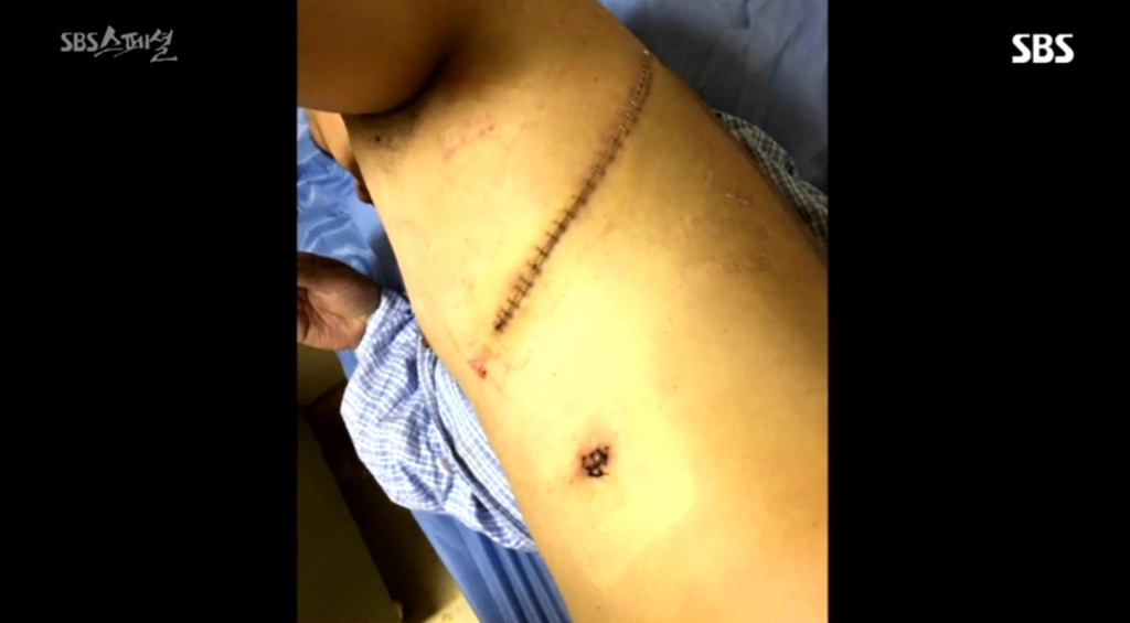 중국-현지-사례로-보는-미세먼지의-위험성.jpg-5-이미지