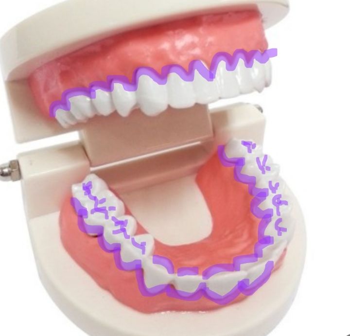 백날-열심히-칫솔질-치실질해도-안-닦이는-부분-있는-달글-(부제-:-첨단칫솔-쓰세요)-2-이미지
