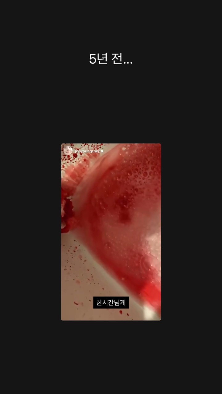 생각보다-심각했던-배우-차주영의-코피-증상.jpg-((((피사진-주의))))-4-이미지