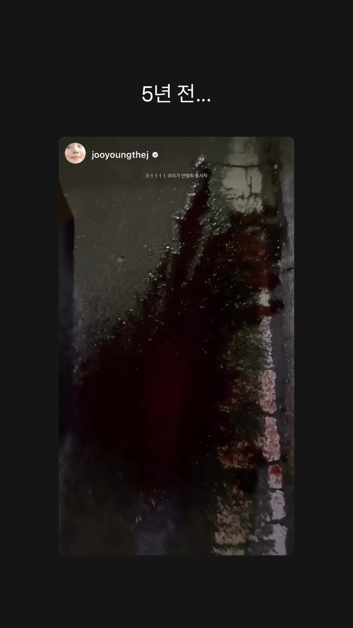 생각보다-심각했던-배우-차주영의-코피-증상.jpg-((((피사진-주의))))-3-이미지