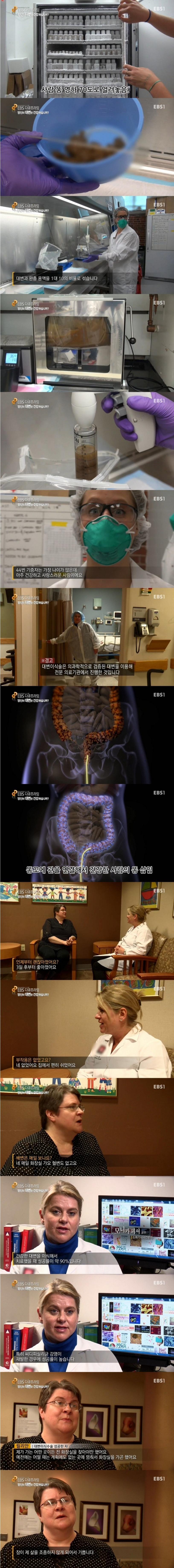 대변이식수술-0-이미지