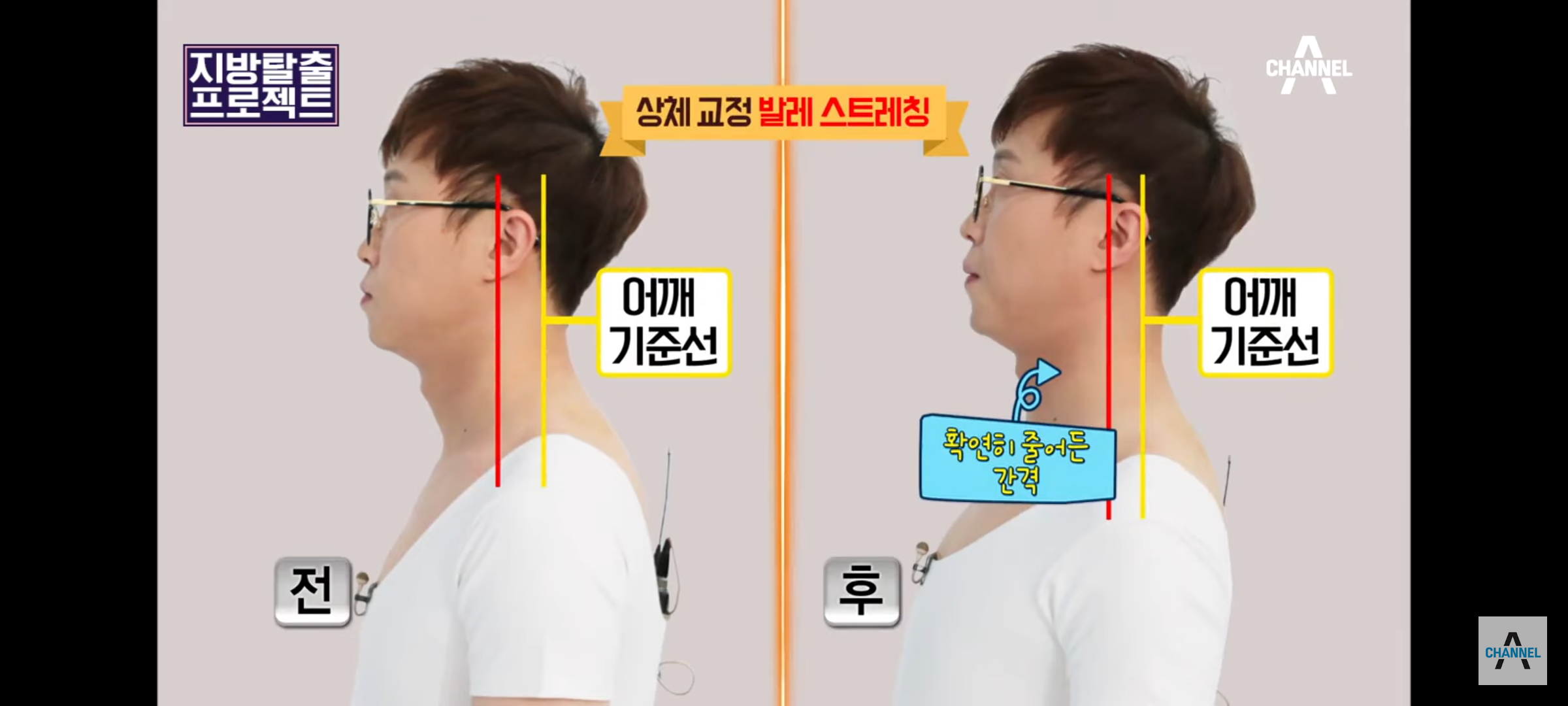 승모근-스트레칭-끝판왕-3-이미지