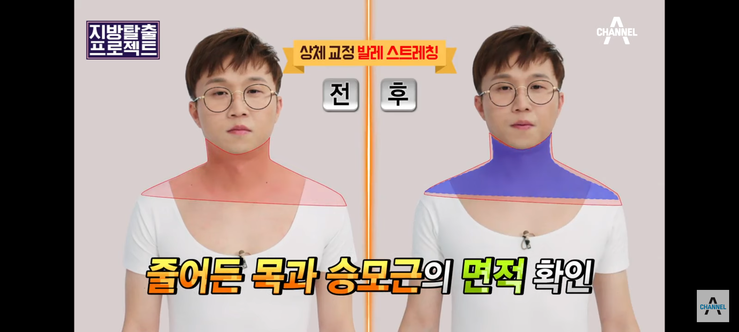 승모근-스트레칭-끝판왕-4-이미지