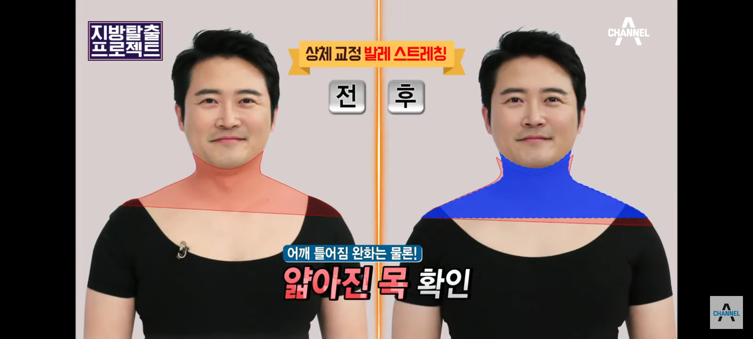 승모근-스트레칭-끝판왕-6-이미지