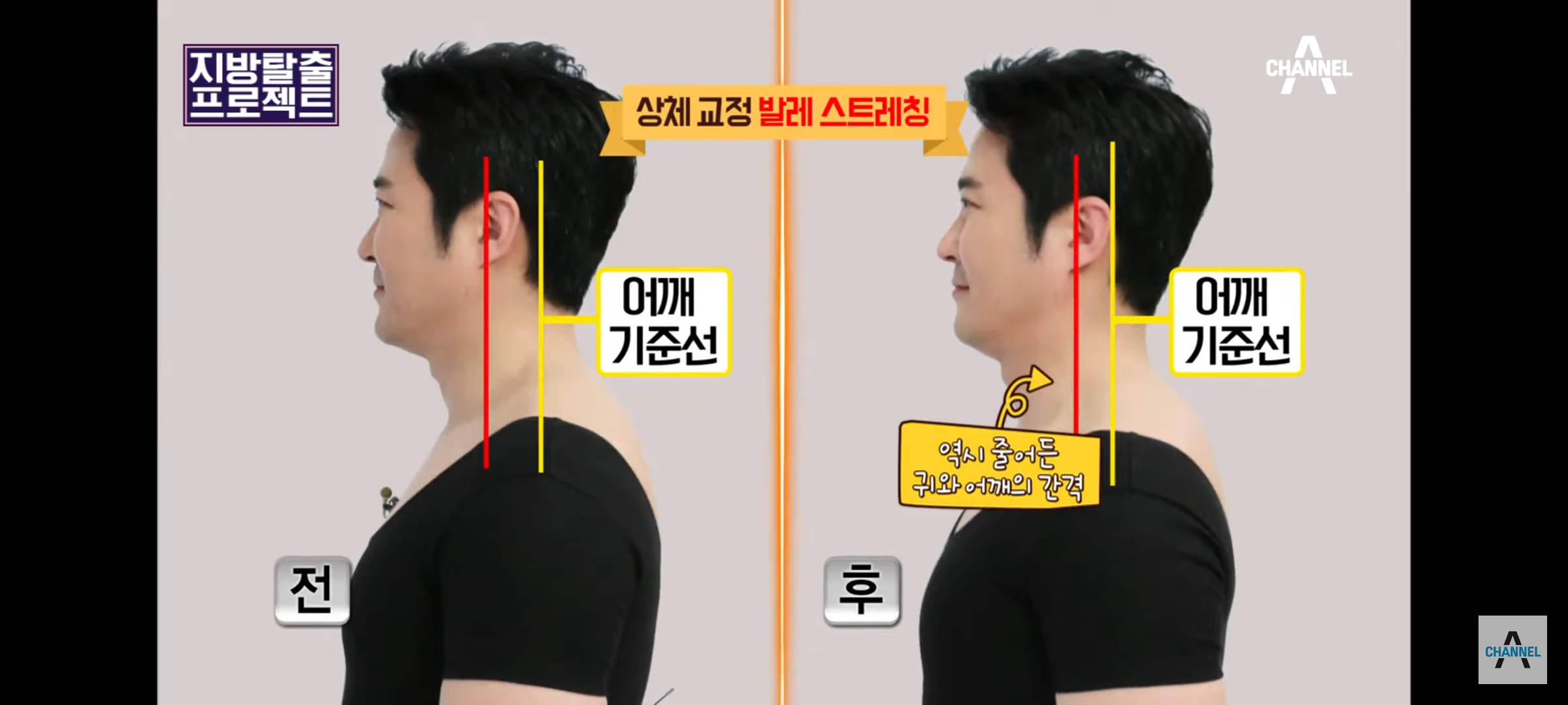 승모근-스트레칭-끝판왕-5-이미지