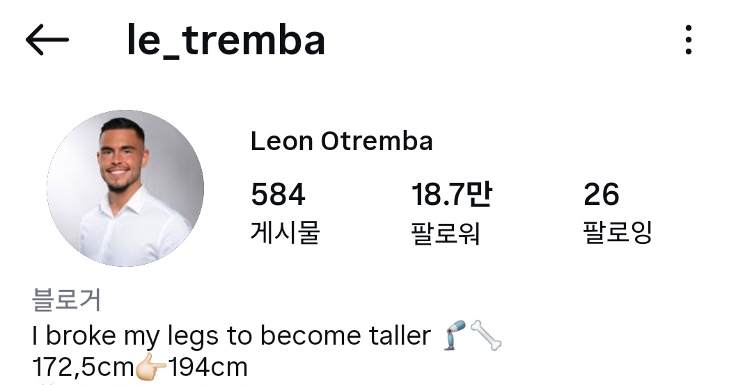 172cm--＞-194cm-키높이-수술-7개월후-후기.gif-0-이미지