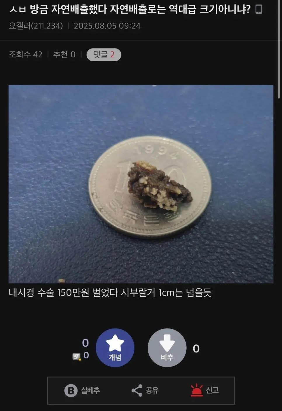 내시경-수술-150만원-벌었다-0-이미지