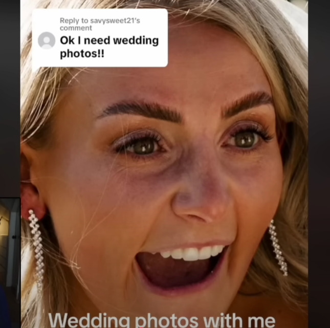 보톡스-주사시술이-불러일으킬-수-있는-부작용-9-이미지