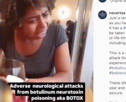 보톡스-주사시술이-불러일으킬-수-있는-부작용-6-이미지