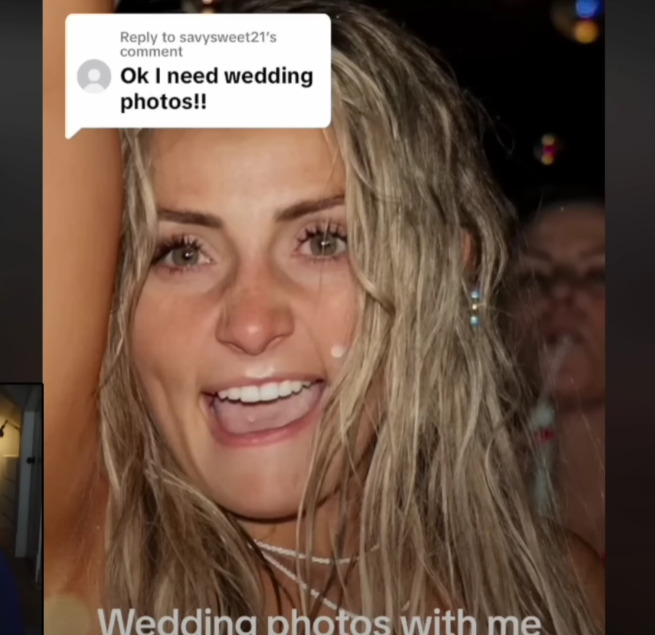 보톡스-주사시술이-불러일으킬-수-있는-부작용-8-이미지