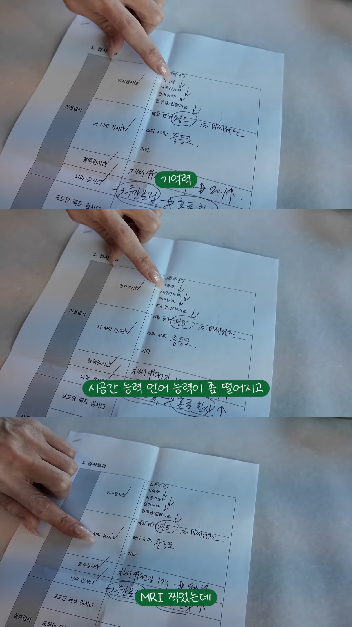 유전이라는-유튜버-삐루빼로-할머니의-치매.jpg-1-이미지