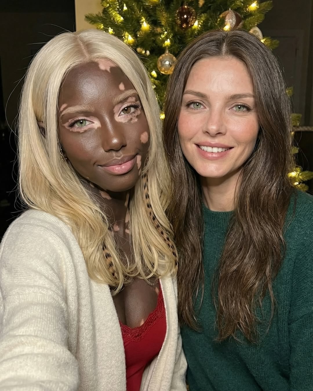 백인-엄마와-백반증-있는-흑인-아빠-사이에서-낳은-딸-8-이미지