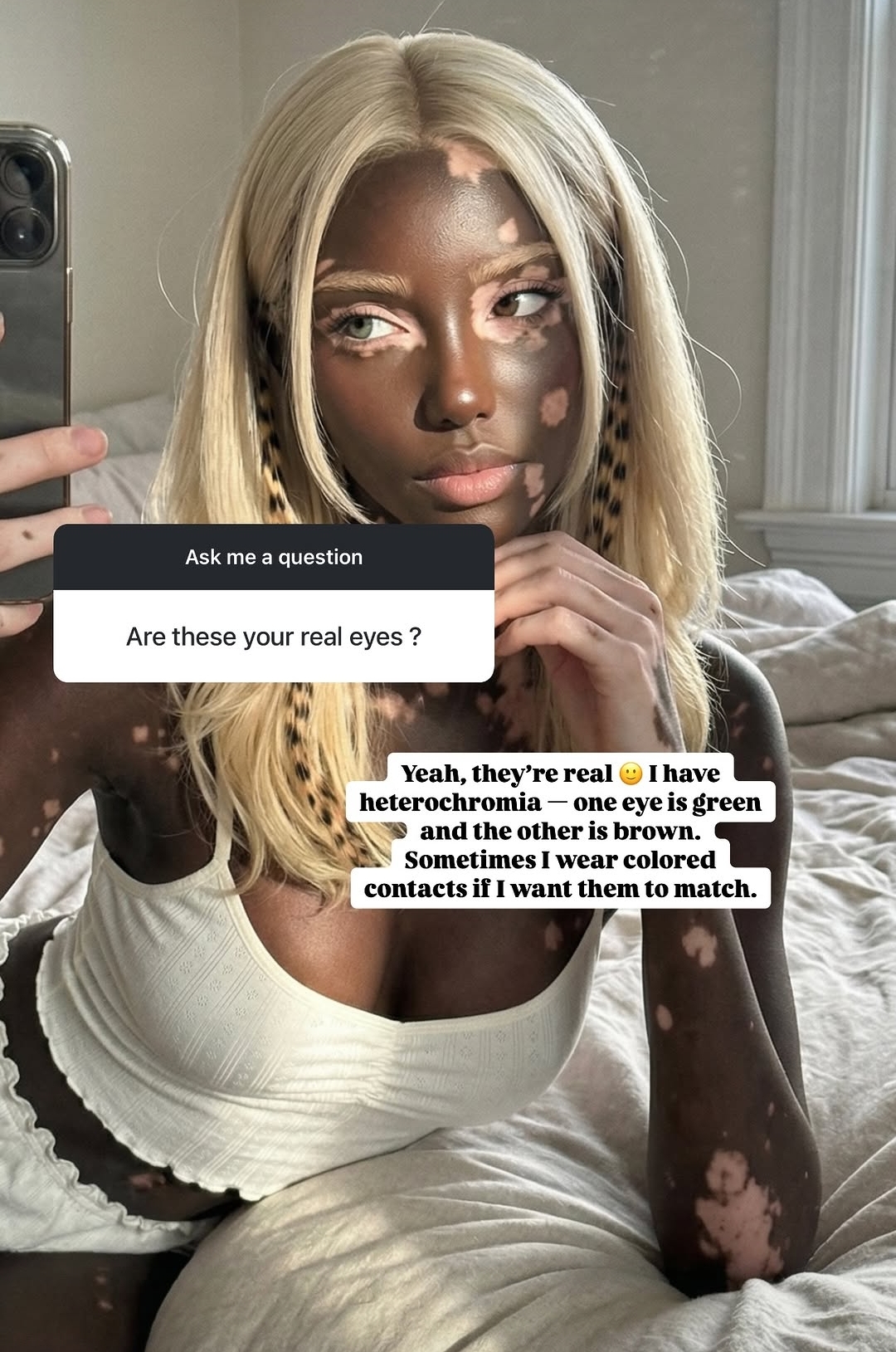 백인-엄마와-백반증-있는-흑인-아빠-사이에서-낳은-딸-17-이미지