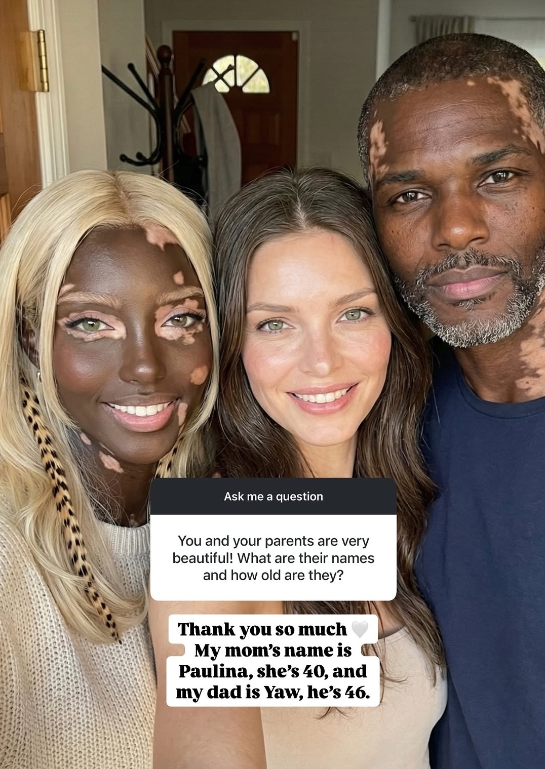 백인-엄마와-백반증-있는-흑인-아빠-사이에서-낳은-딸-18-이미지