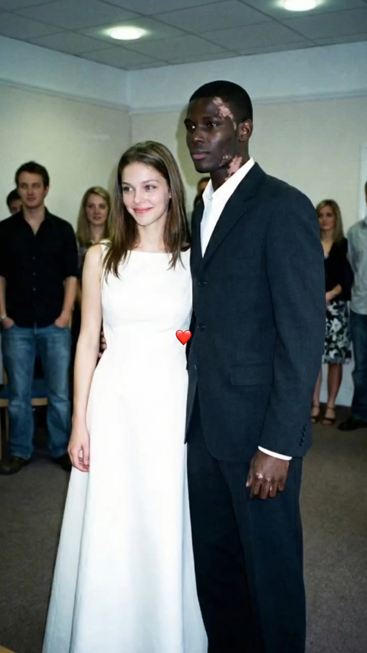 백인-엄마와-백반증-있는-흑인-아빠-사이에서-낳은-딸-2-이미지