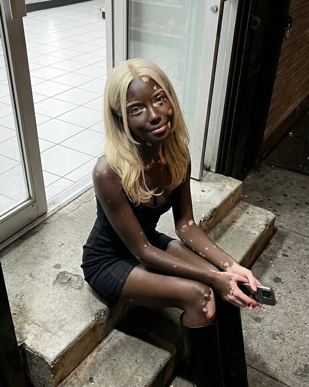 백인-엄마와-백반증-있는-흑인-아빠-사이에서-낳은-딸-12-이미지