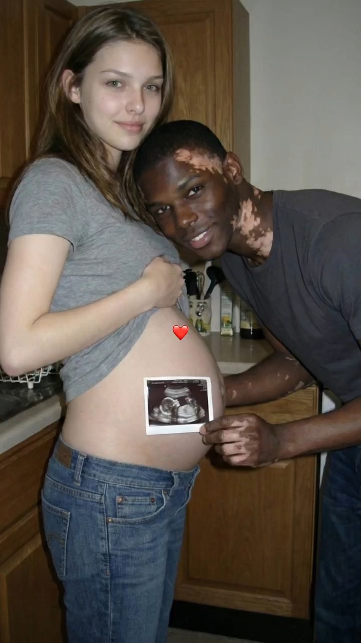 백인-엄마와-백반증-있는-흑인-아빠-사이에서-낳은-딸-3-이미지