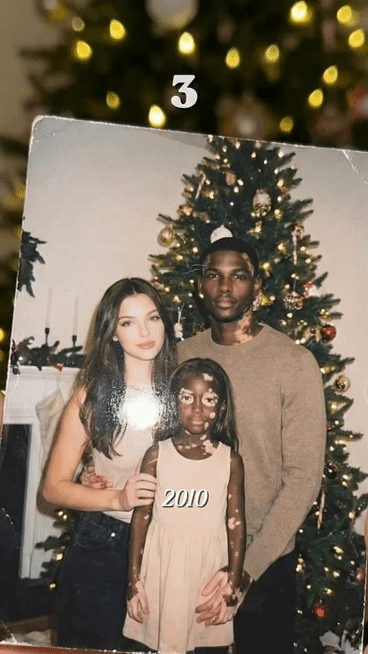 백인-엄마와-백반증-있는-흑인-아빠-사이에서-낳은-딸-6-이미지