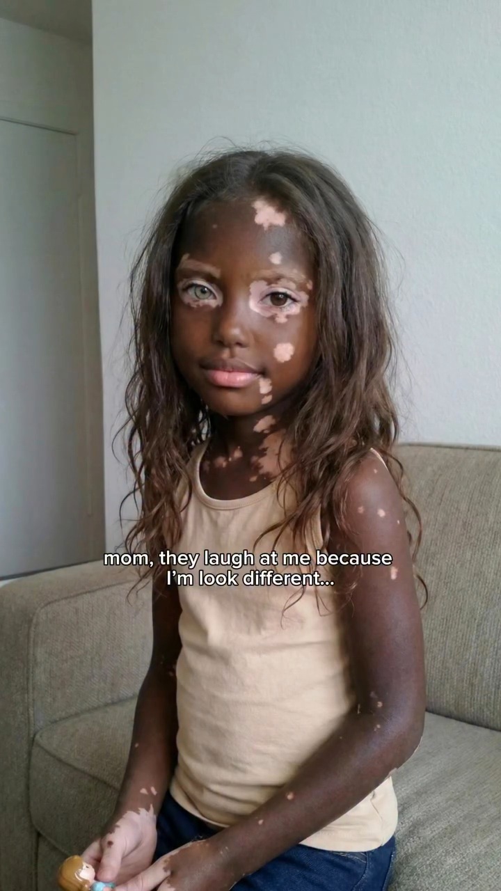 백인-엄마와-백반증-있는-흑인-아빠-사이에서-낳은-딸-4-이미지