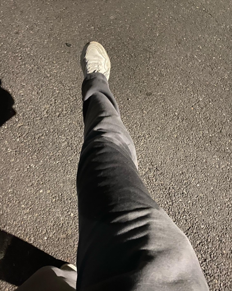 보행장애-대형견과의-마지막-1년-81-이미지