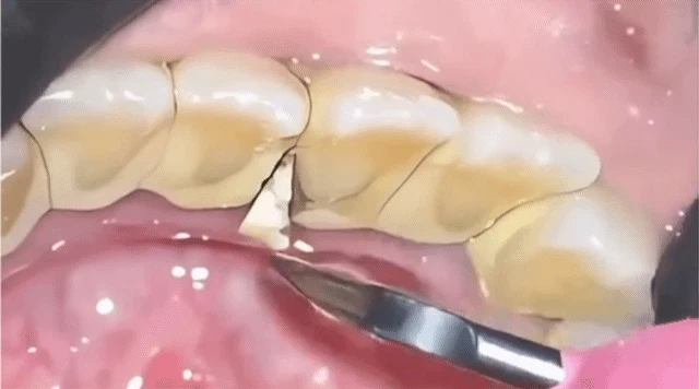 시원한-스케일링-1-이미지