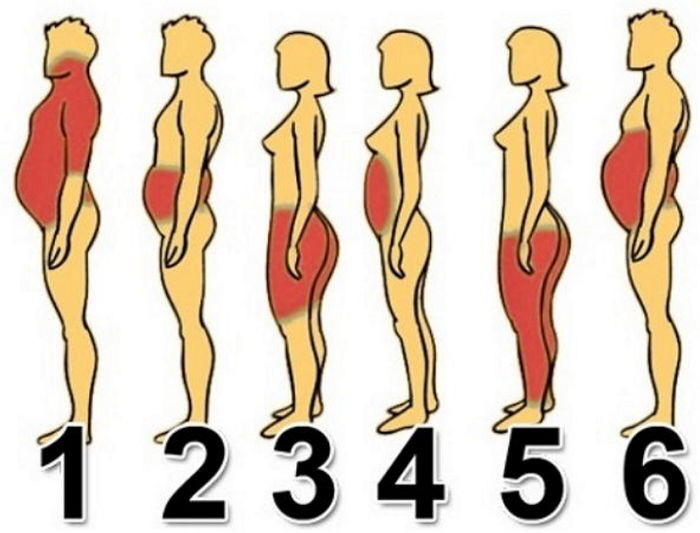 '살찐-부위'로-알아보는-비만-유형-6가지.JPG-0-이미지