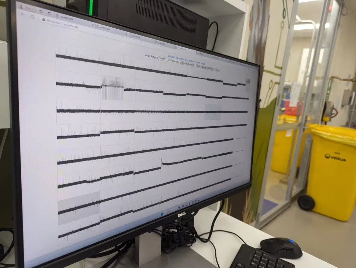 세계-최초-"통속의-뇌"-구현-2-이미지