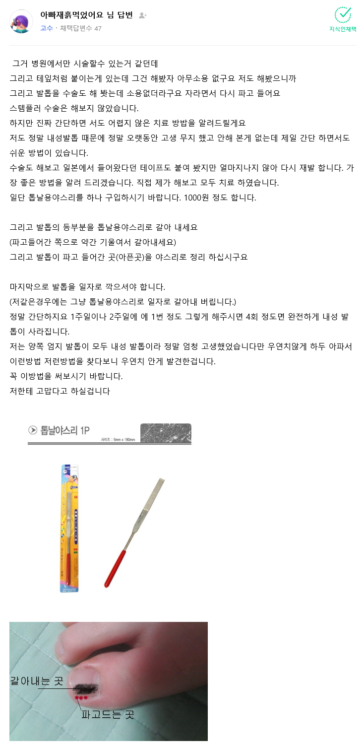 내성발톱으로-고통받는자를-구원하기-위해-신의-계시를-받은자.jpg-2-이미지
