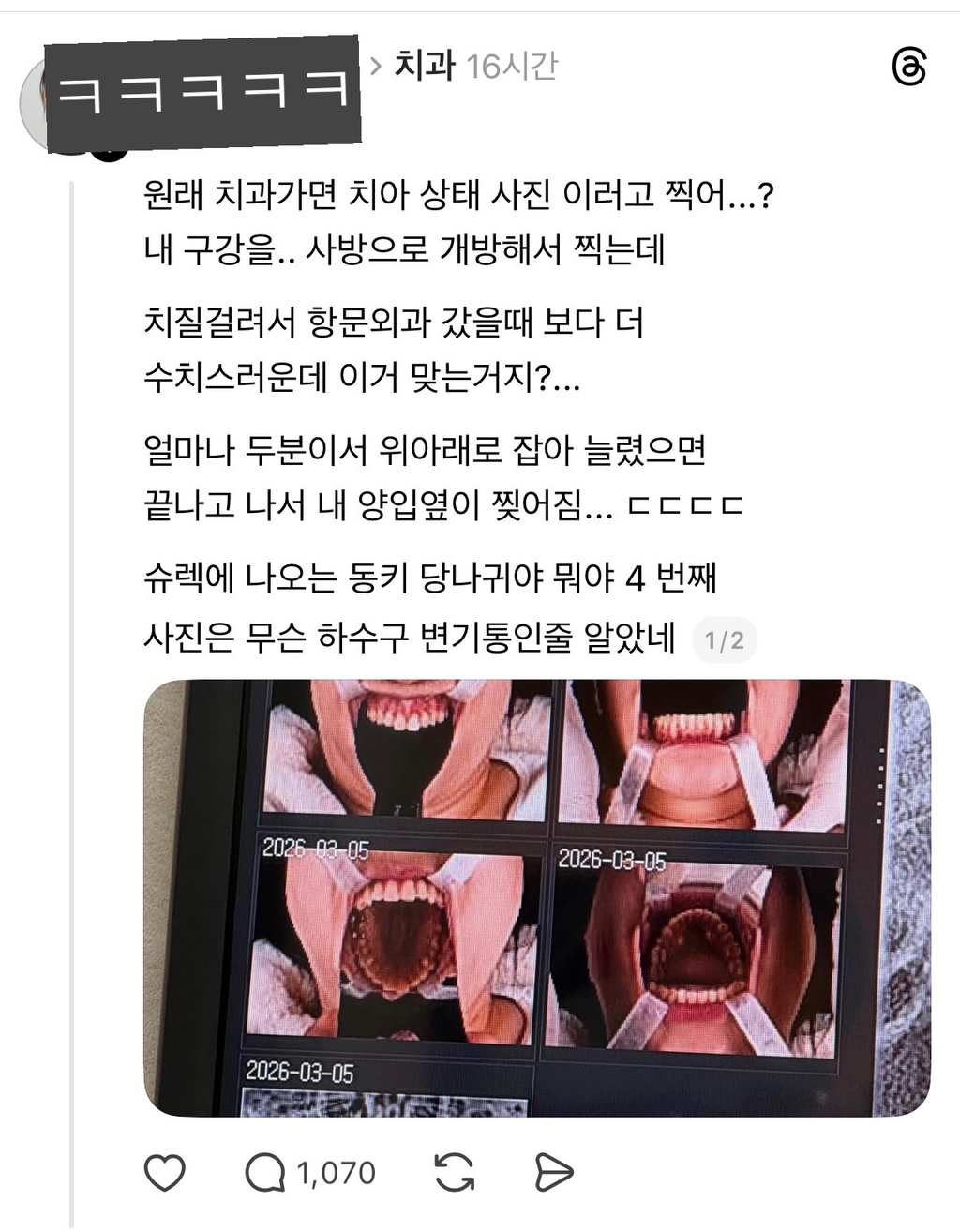 [스레드]-원래-치과가면-이렇게-찍어?-0-이미지