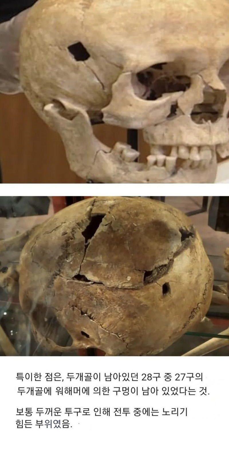 15세기-영국,-병사들의-유골-7-이미지