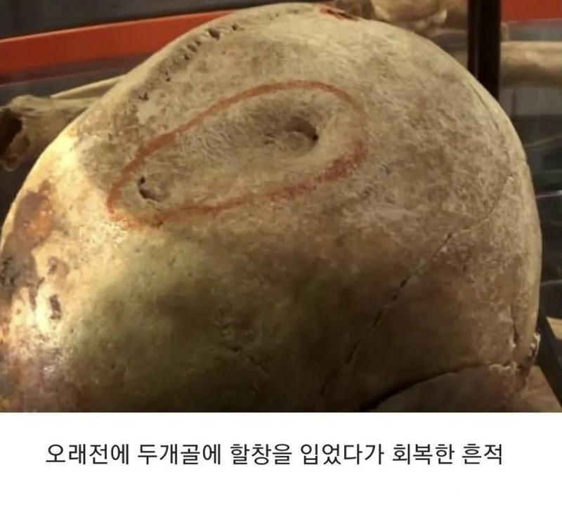 15세기-영국,-병사들의-유골-4-이미지