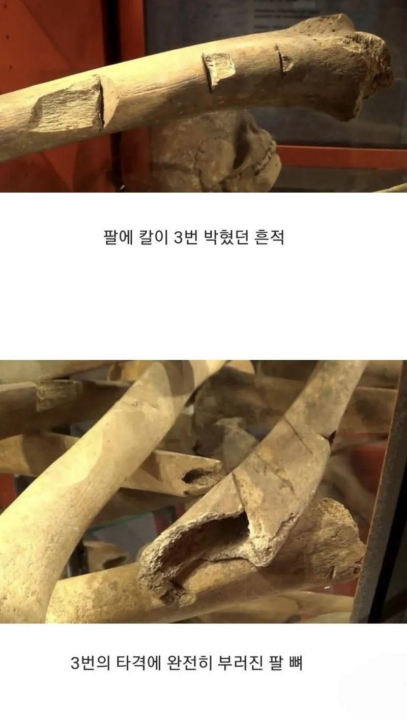 15세기-영국,-병사들의-유골-2-이미지