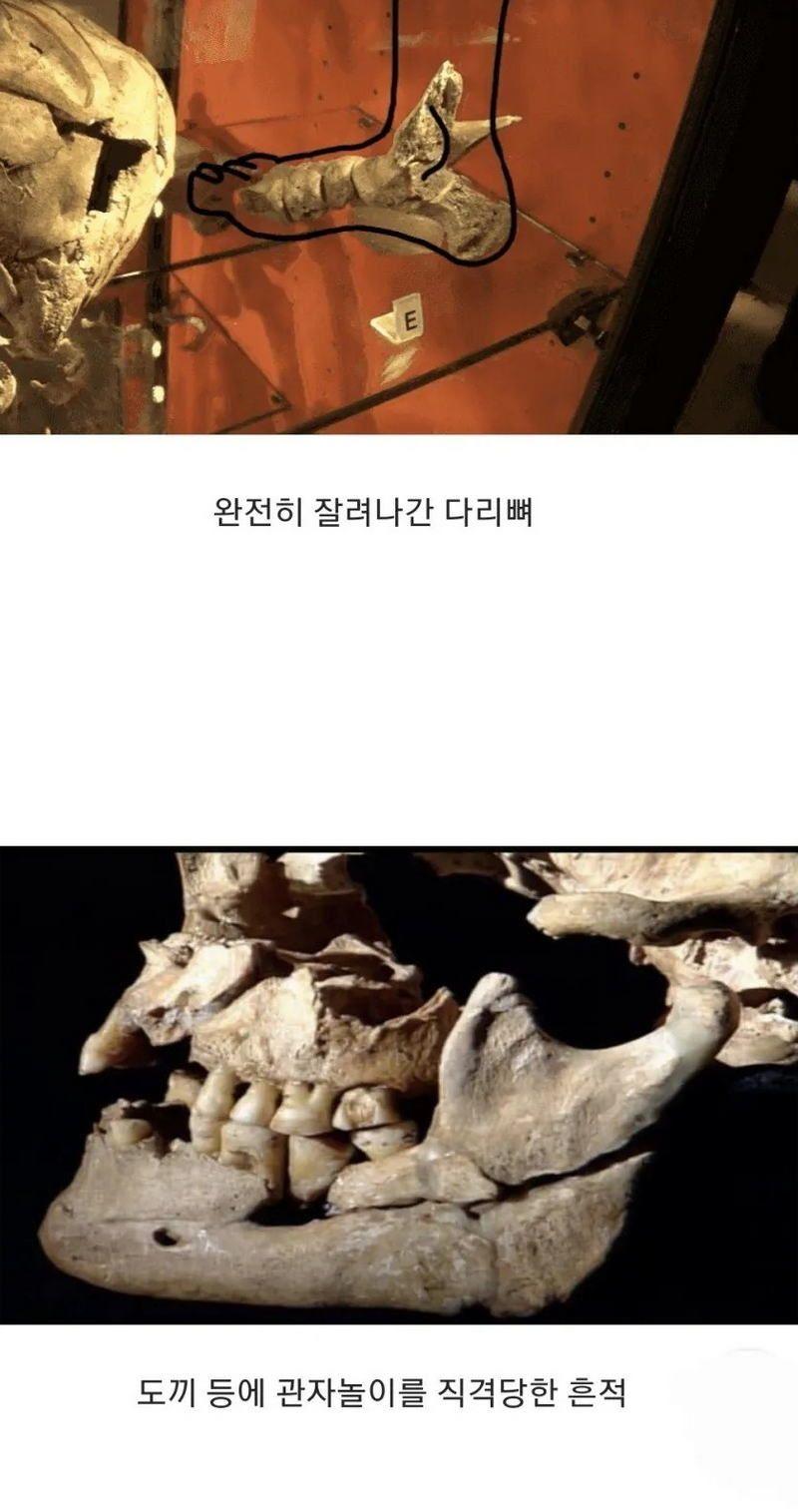 15세기-영국,-병사들의-유골-5-이미지