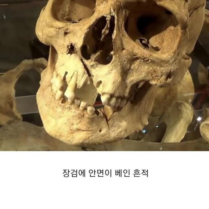15세기-영국,-병사들의-유골-6-이미지