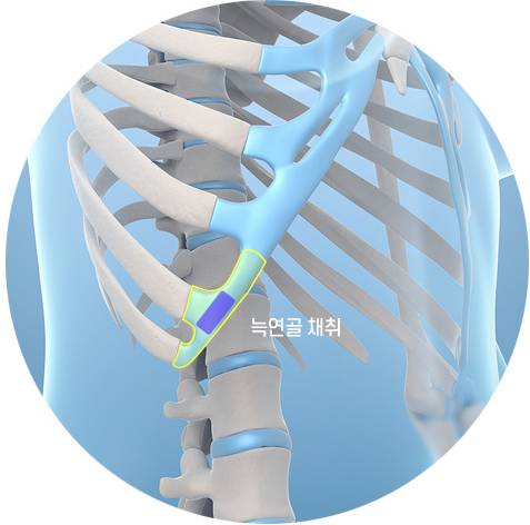 기기괴괴-그-자체인-요즘-유행한다는-코-수술-방법(약혐)-0-이미지