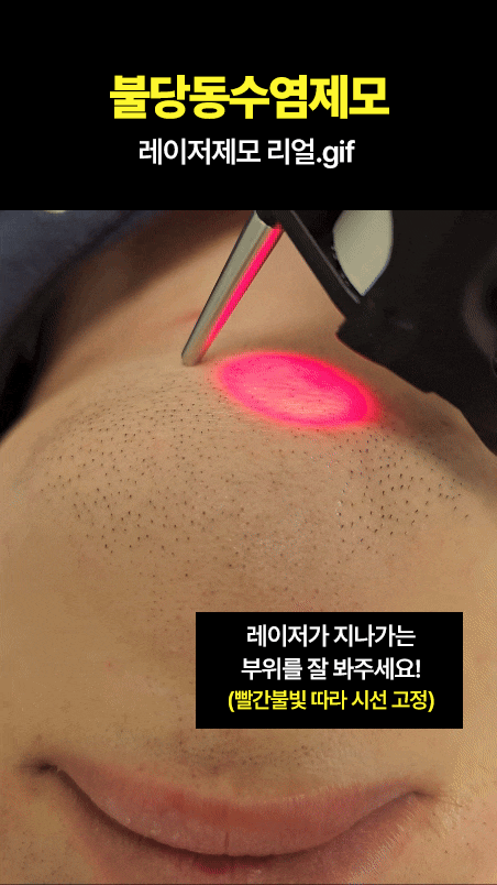 톡쏘는-시원함과-청량감이-있는-레이져제모-시술-1-이미지