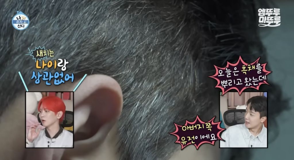 생각보다-젊은-사람들도-많다는-흰머리-4-이미지