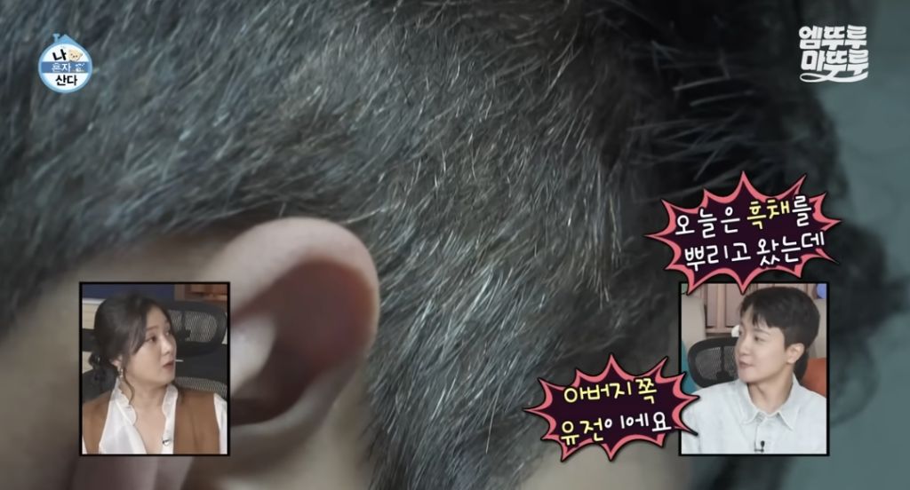 생각보다-젊은-사람들도-많다는-흰머리-3-이미지