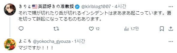 치과-드릴이-혀에-들어갈까봐-무서워요.jpg-2-이미지