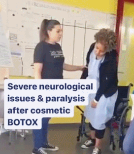 보톡스-주사시술이-불러일으킬-수-있는-부작용-5-이미지