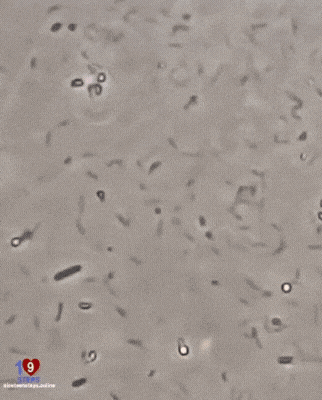 흔히-빨간약이라고-부르는-소독약-포비돈의-위력.gif-0-이미지