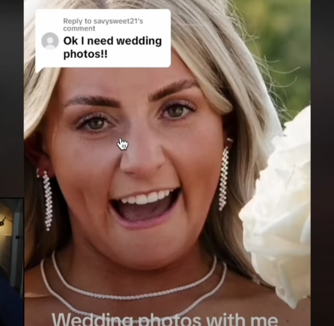 보톡스-주사시술이-불러일으킬-수-있는-부작용-12-이미지